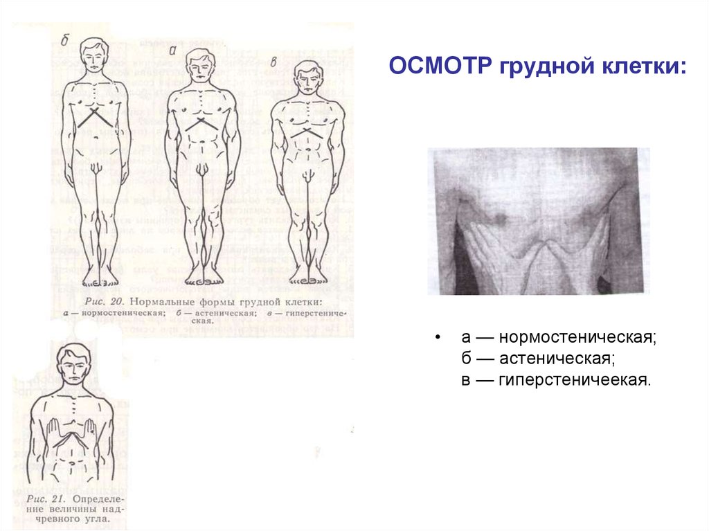 Осмотр грудной клетки