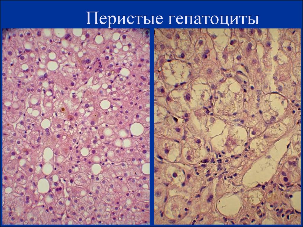 Гепатоциты. Гепациты печеночных клеток. Гепатоциты гистология. Гепатоциты печени. Звездчатые ретикулоэндотелиоциты печени.