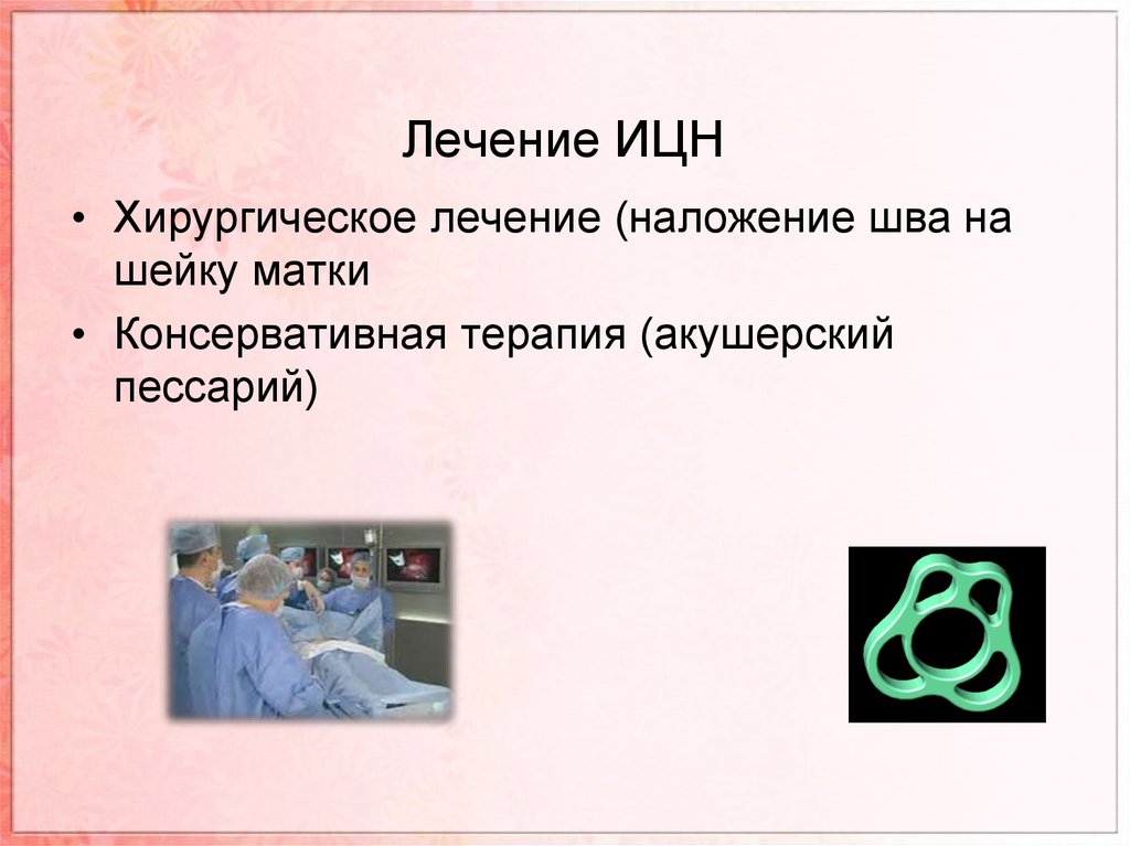 Наложили шов на шейку матки. Истмико цервикальная недостаточность пессарий. ИЦН Акушерство гинекология. Хирургическое лечение истмико цервикальной недостаточности.