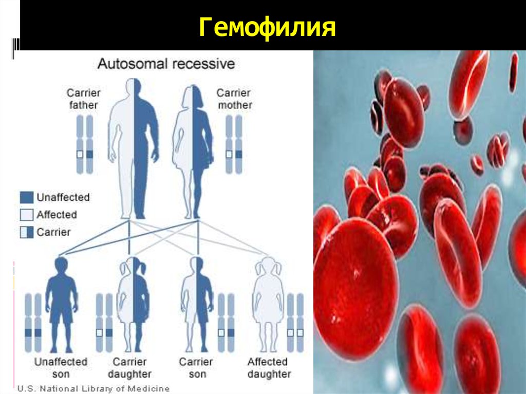 Наследственные болезни крови