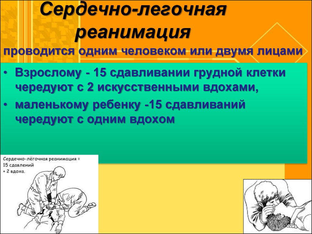 Мероприятия сердечно легочной реанимации