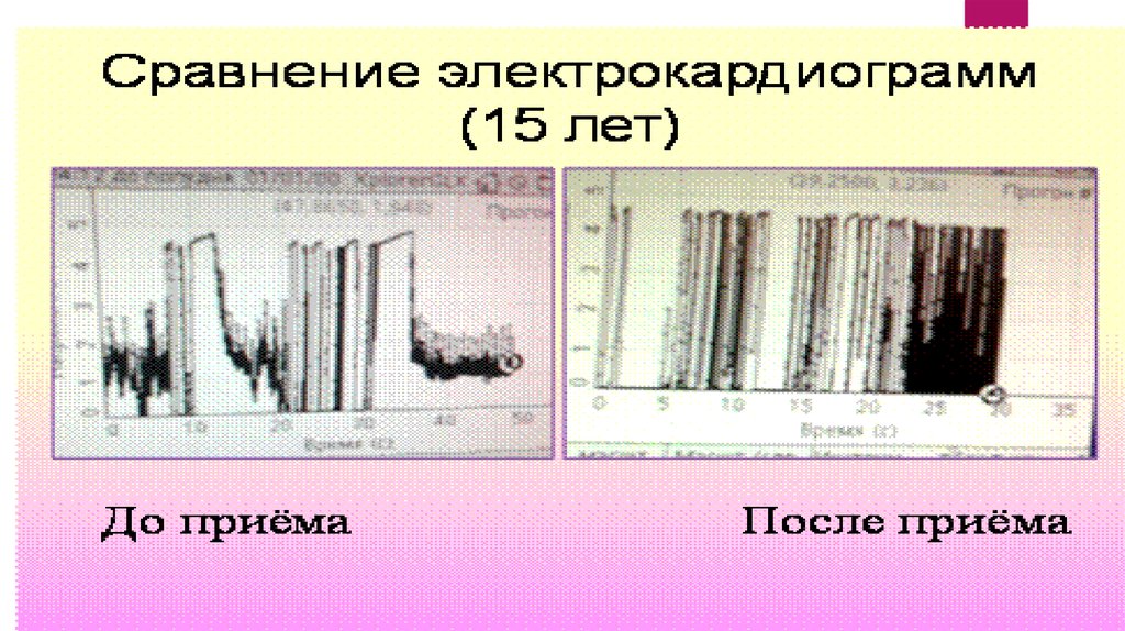 Энергетикалық сусындардың зияны презентация