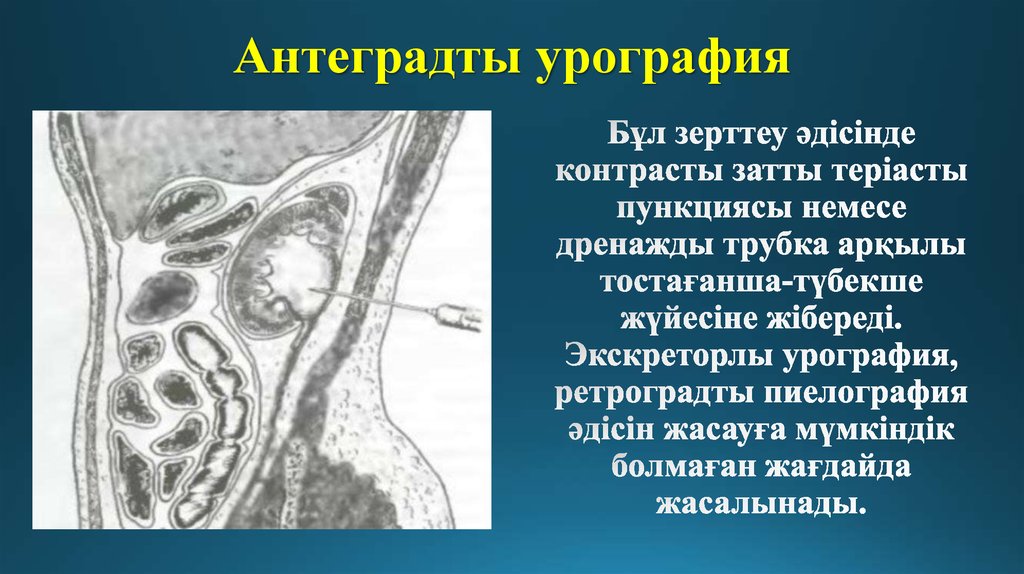 Жалпы зәр анализі презентация