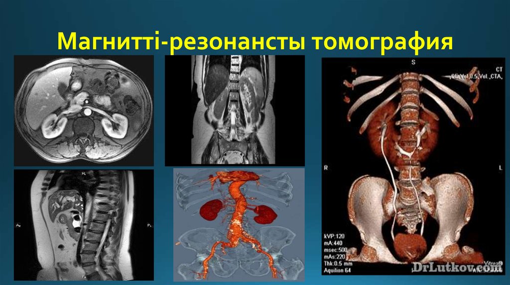 Магнитті-резонансты томография