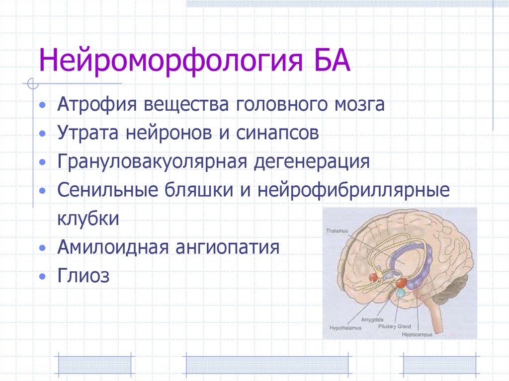 Атрофия вещества головного мозга. Атрофия извилин головного мозга.