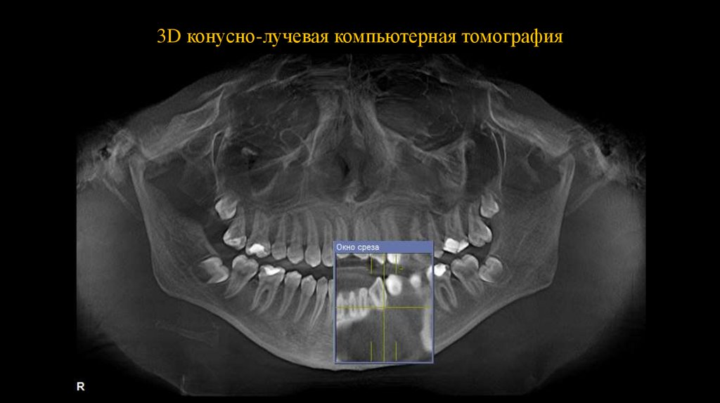 Клкт это. Конусно-лучевая компьютерная томография челюстей. Компьютерная томография челюстно-лицевой области 3d. Конусно-лучевая компьютерная томография (КЛКТ). 3д томография челюстно лицевой области.