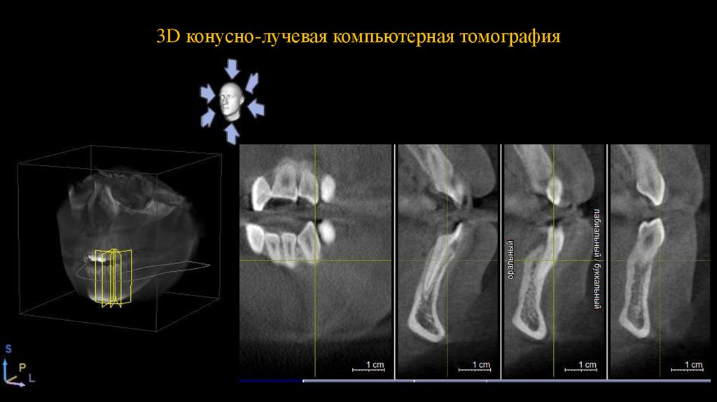 Клкт. КЛКТ конусно-лучевая компьютерная томография или 3d кт. Конусно-лучевая компьютерная томография (КЛКТ). Конусно - лучевая компьютерная томография 3d. 9. Конусно-лучевая компьютерная томография это.