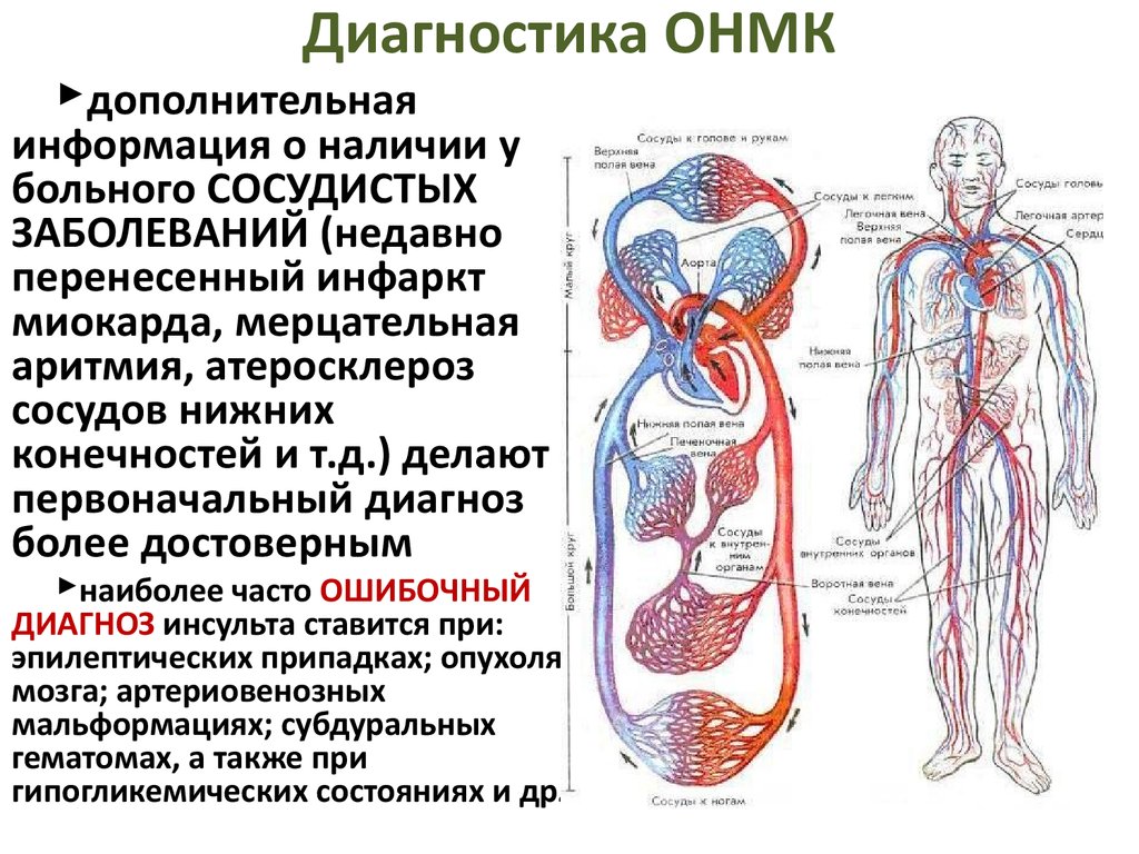 Нарушение мозгового кровообращения диагностика