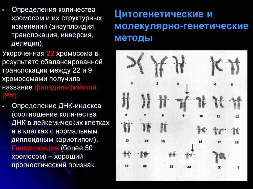 Генетическое исследование хромосом. Филадельфийская хромосома кариотип. Цитогенетические методы. Цитогенетический метод исследования. Цитогенетические и молекулярно-цитогенетические методы.