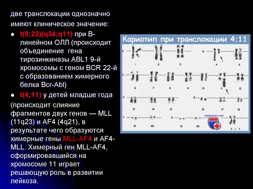 14 хромосома. Робертсоновская транслокация 13 кариотип. Робертсоновская транслокация 21 хромосомы на 21. Транслокация кариотип. Кариотип при транслокации.