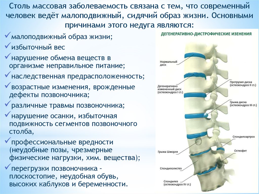 Остеохондроз поясничного отдела 1 периода. Остеохондроз шейного отдела позвоночника с3-с7. Остеохондроза дисков пояснично-крестцового отдела. Спондилоартроз пояснично-крестцового отдела позвоночника th12 s1.