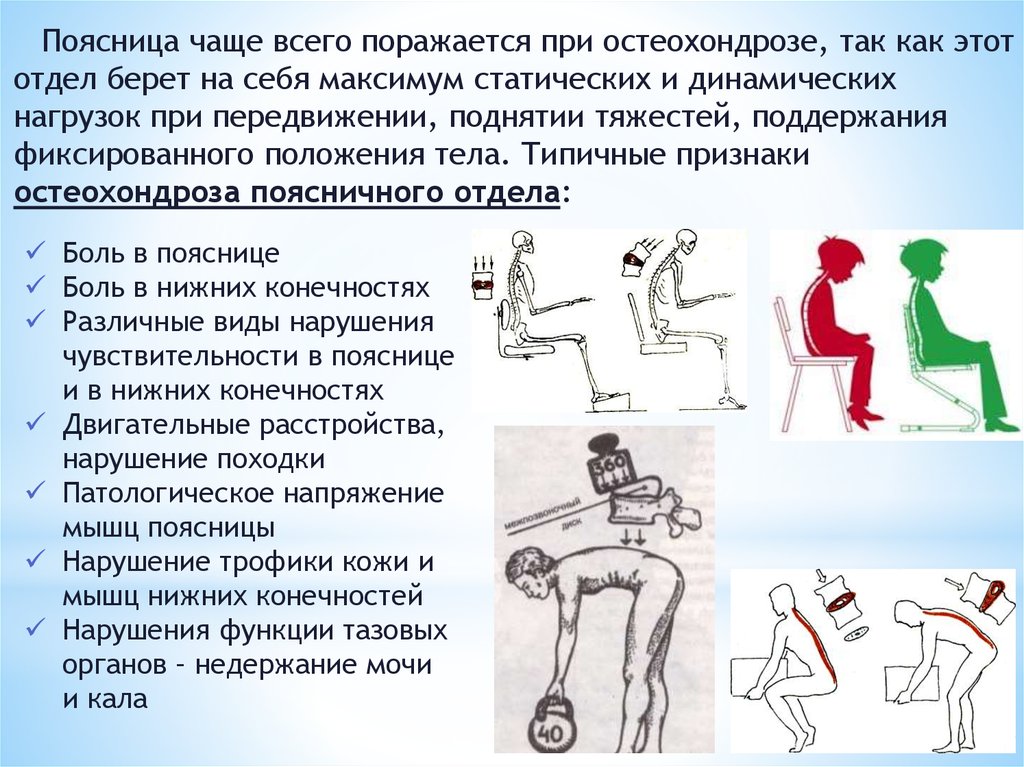 Факторы остеохондроза. Памятка по профилактике остеохондроза. Профилактика остеохондроза поясничного отдела. Профилактика при остеохондрозе поясничного отдела позвоночника. Рекомендации при остеохондрозе поясничного отдела.