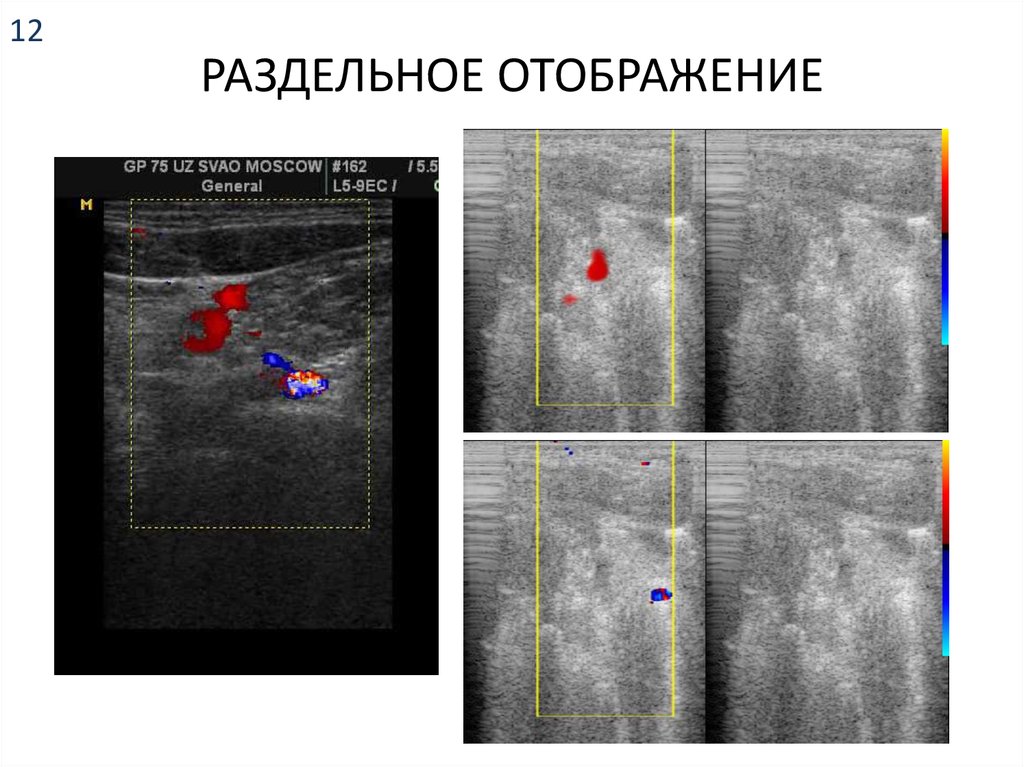 РАЗДЕЛЬНОЕ ОТОБРАЖЕНИЕ