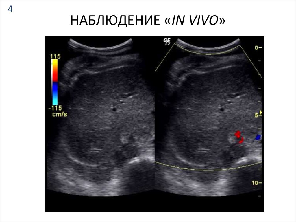 НАБЛЮДЕНИЕ «IN VIVO»