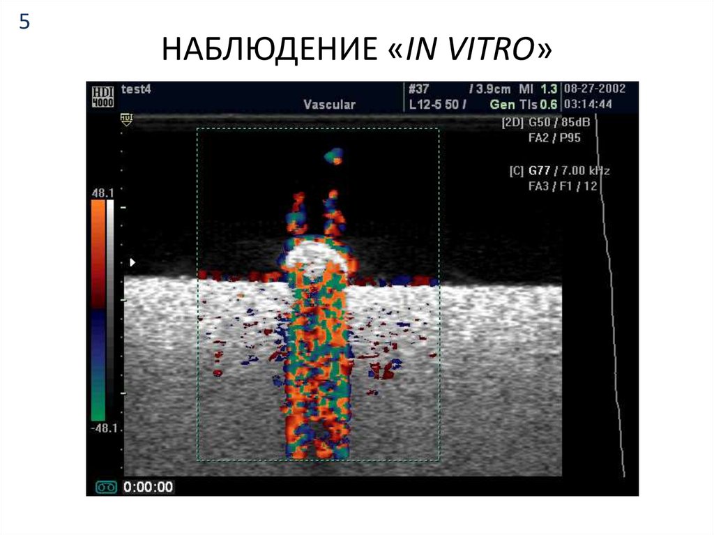НАБЛЮДЕНИЕ «IN VITRO»