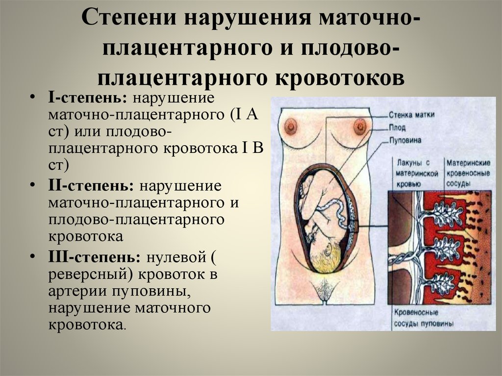 Причины нарушения маточно-плацентарного кровотока