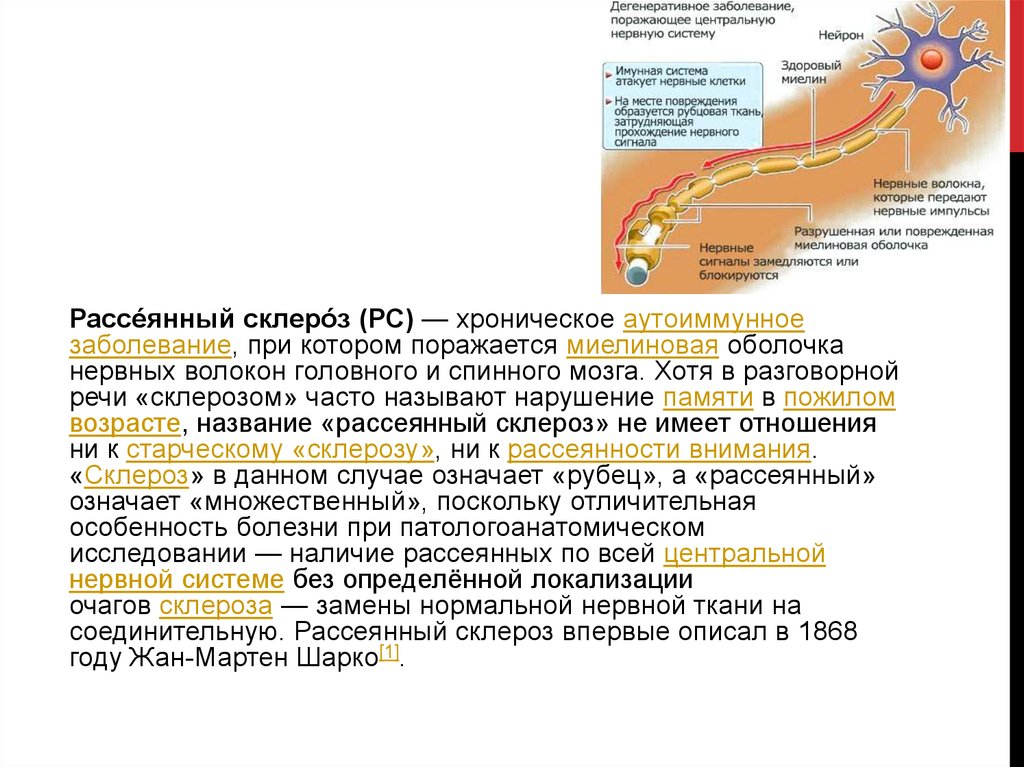 Рассеянный склероз неврология презентация