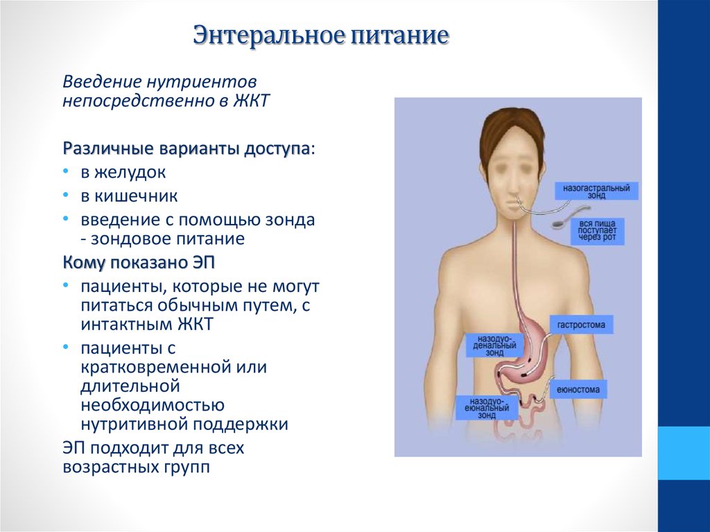 Питание через. Кормление энтеральное через зонд. Энтеральное питание это Введение. Энтерального зондового питания. Искусственное энтеральное питание.