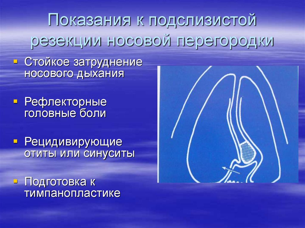 В чем преимущество носового дыхания. Затруднение носового дыхания. Затруднённое дыхание носом. Степени затруднения носового дыхания. Физиологические особенности носового дыхания.