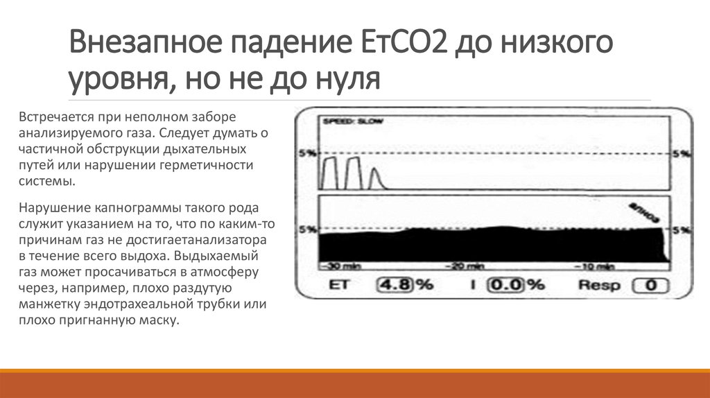 Капнография в мониторе для чего