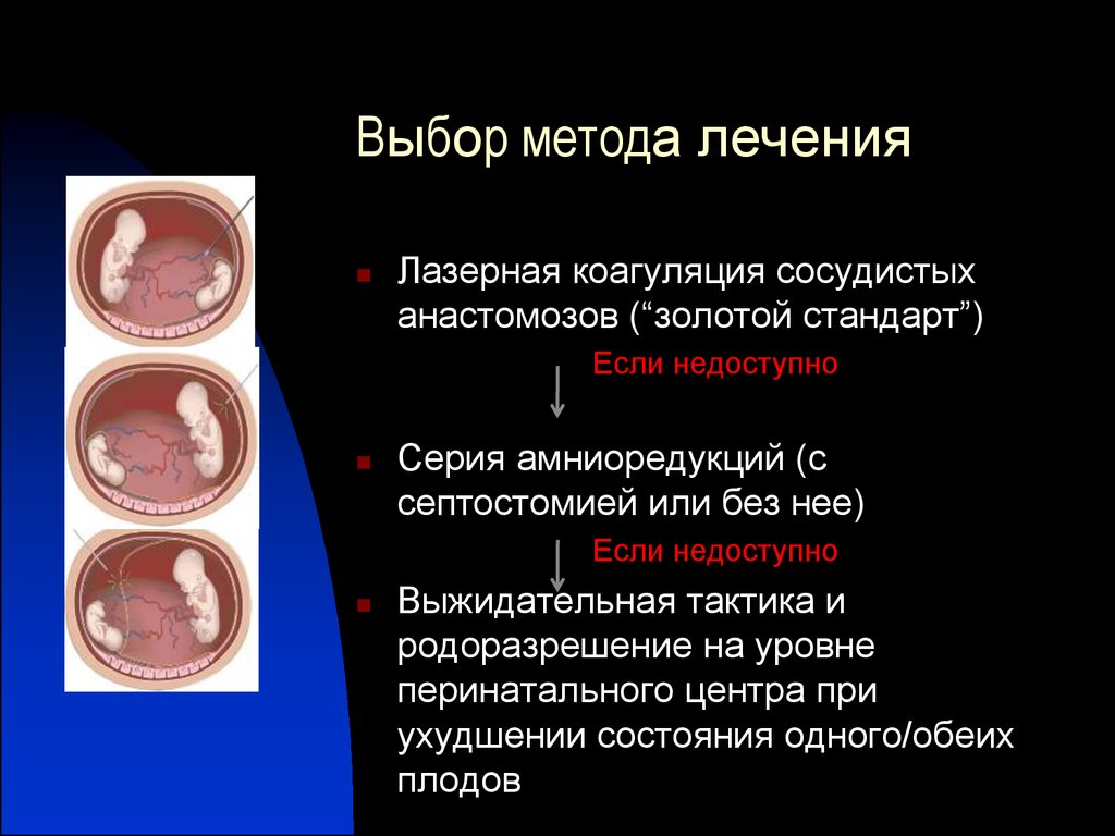 Многоплодная беременность презентация. Идезия многоплодная. Факторы способствующие многоплодной беременности. Осложнения многоплодной беременности.