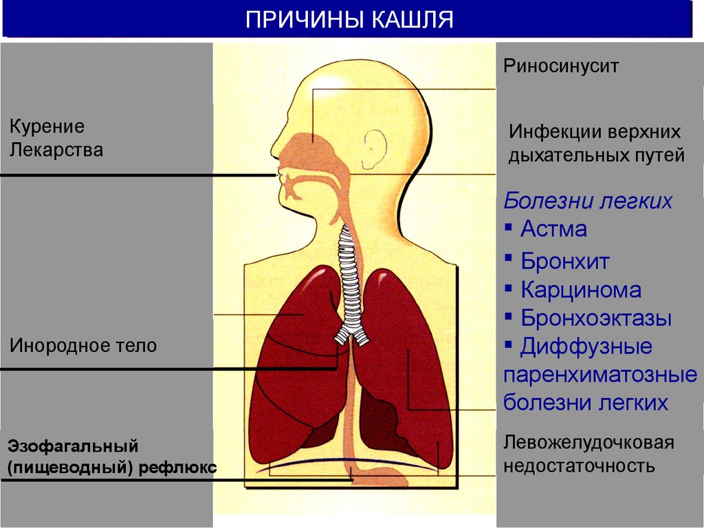 Тест заболевания верхних дыхательных путей