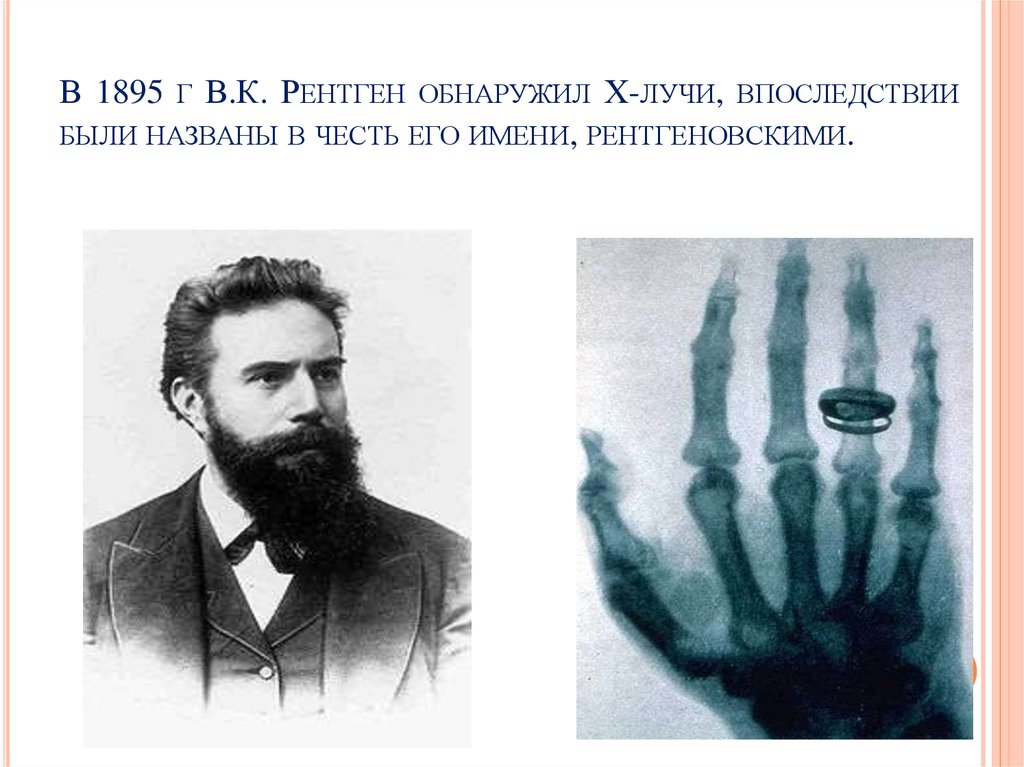 Открытие х лучей. 1895 Г.– лучи рентгена.