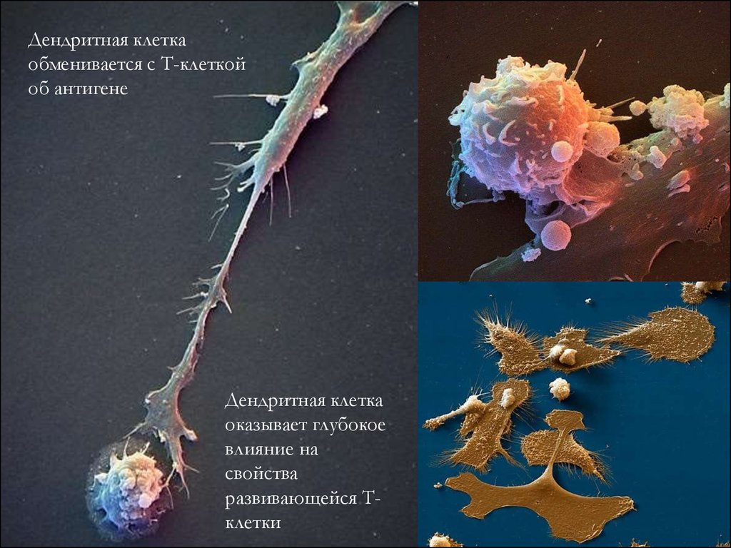 Реакция высших лун на т и. Дендритные клетки иммунология. Дендритные клетки гистология. Дендритные клетки под микроскопом. Незрелые дендритные клетки.