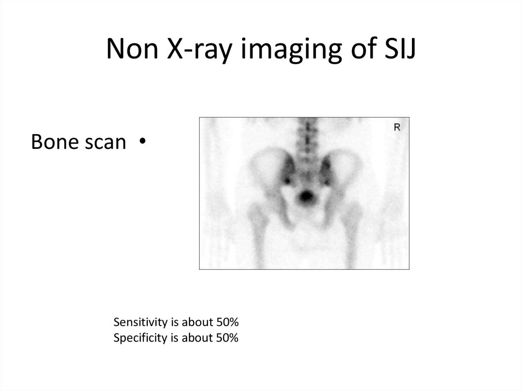 Non X-ray imaging of SIJ