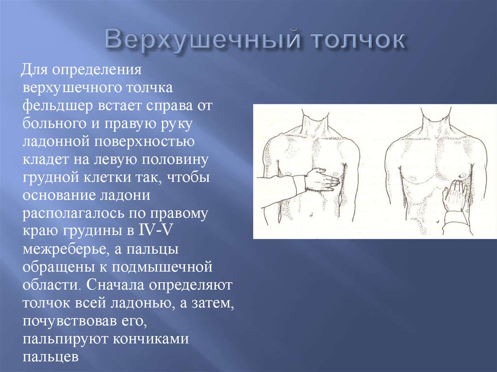 Определить толчок. Верхушечный толчок определяется. Методика пальпации верхушечного толчка. Определение верхушечного толчка.