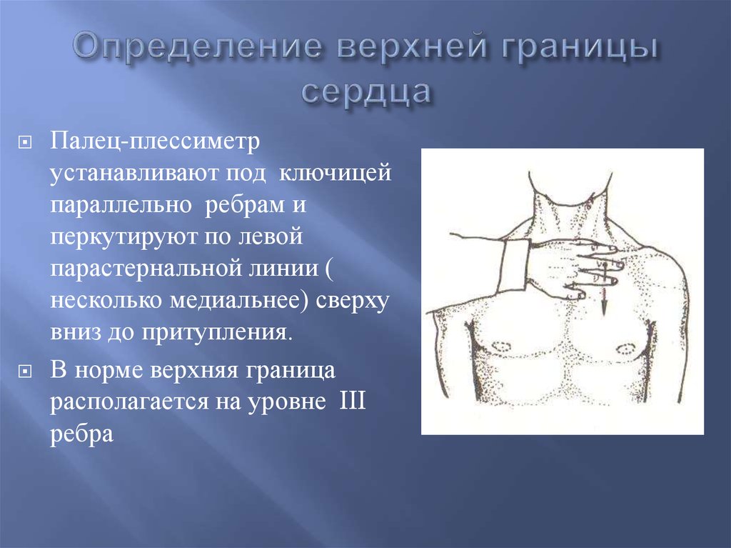 Определить верхний. Определение границ сердца. Верхняя граница сердца определяется. Определение верхней границы сердца. Определение верхней границы.