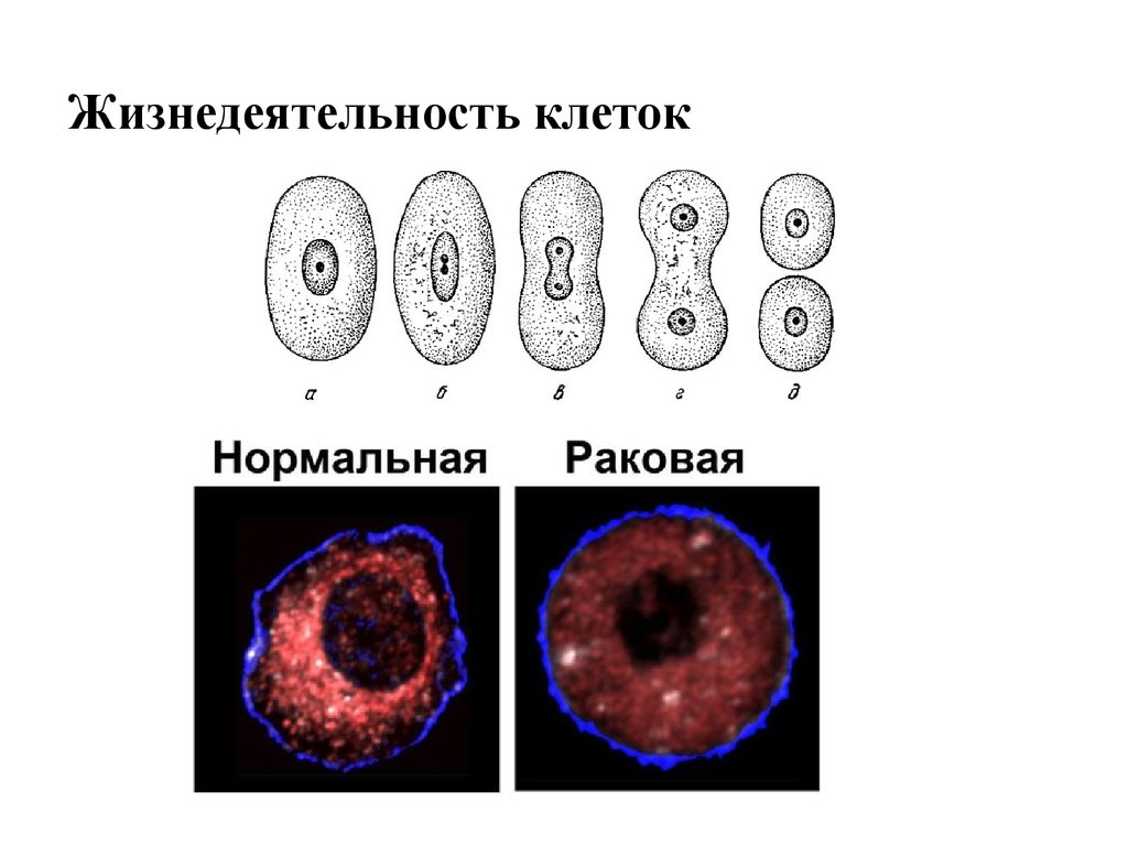 Нормальная клетка. Нормальная клетка и раковая. Раковая клетка строение. Раковые клетки и Здоровые. Здоровая и раковая клетка под микроскопом.