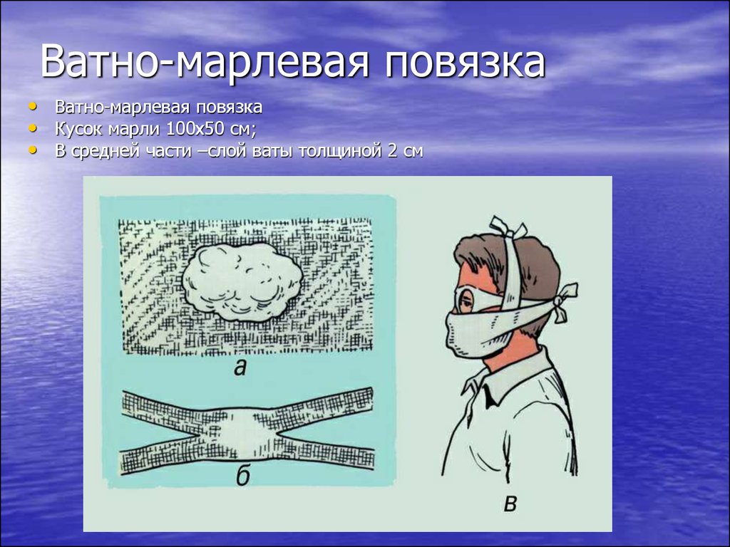 Ватно марлевая повязка презентация