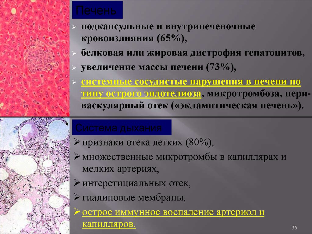 Процесс сопровождающийся накоплением в цитоплазме гепатоцитов