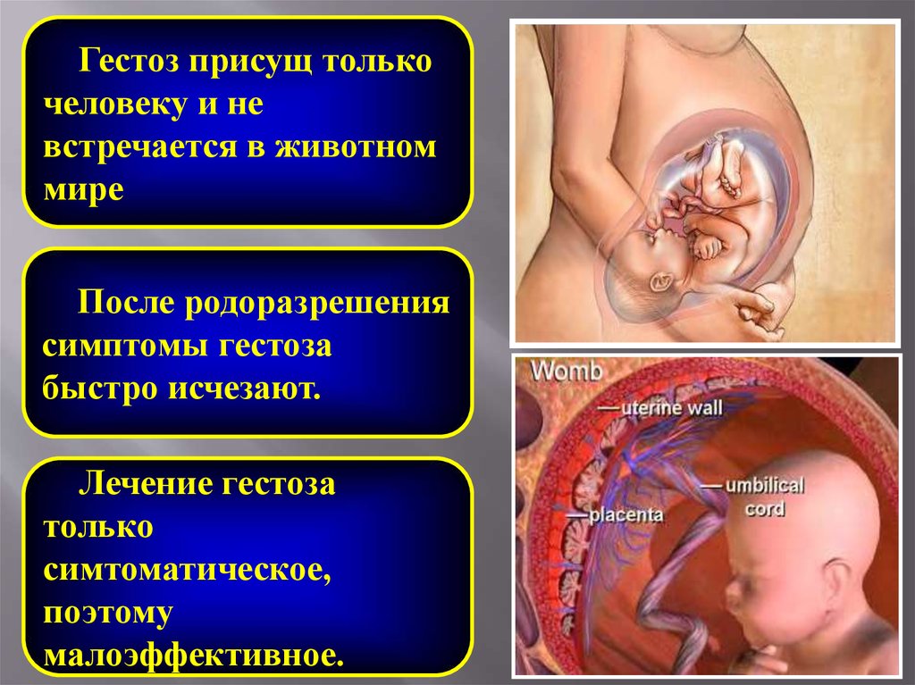 Преэклампсия форум