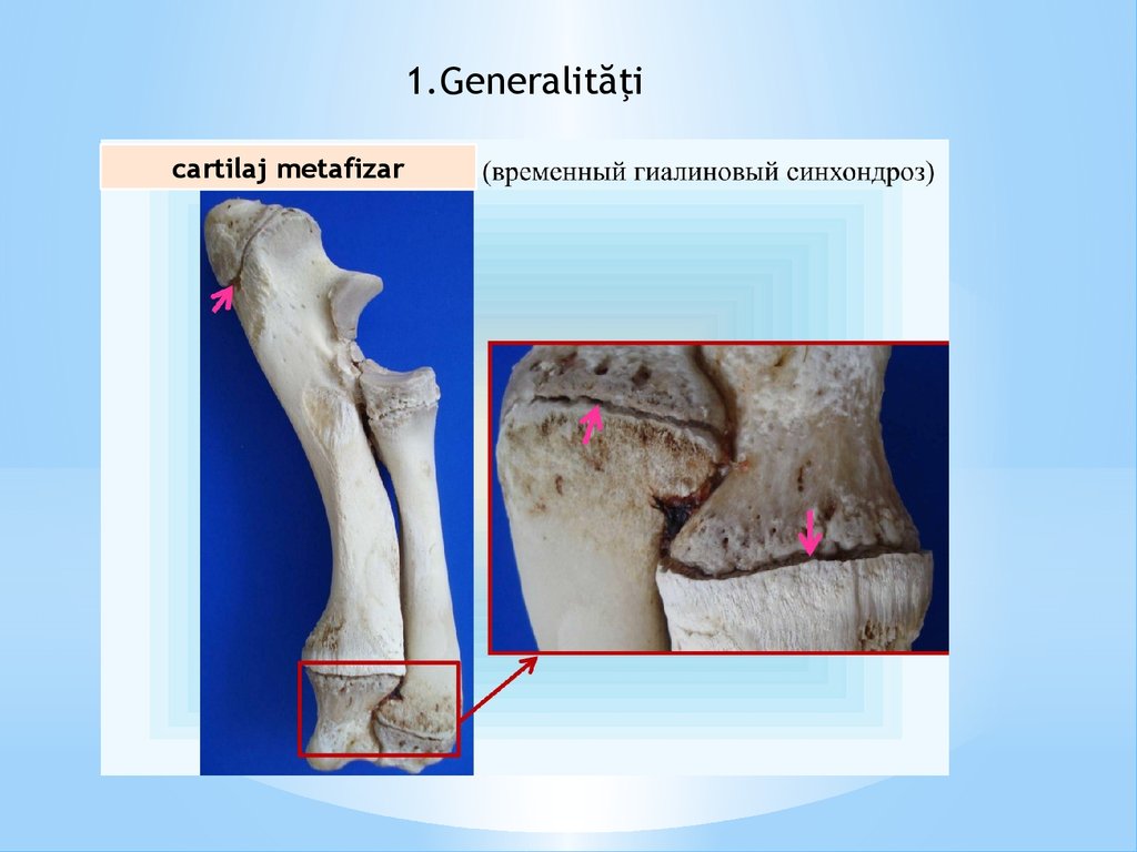 scârțâind dureri în articulația șoldului tratamentul conservator al artrozei genunchiului
