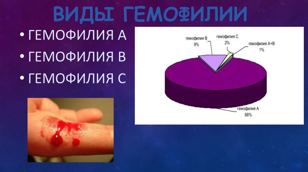 Гемофилия типа а. Причины развития гемофилии. Типы гемофилии гемофилия.