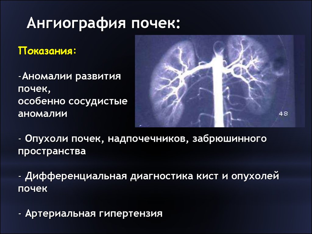 Лучевая диагностика почек презентация