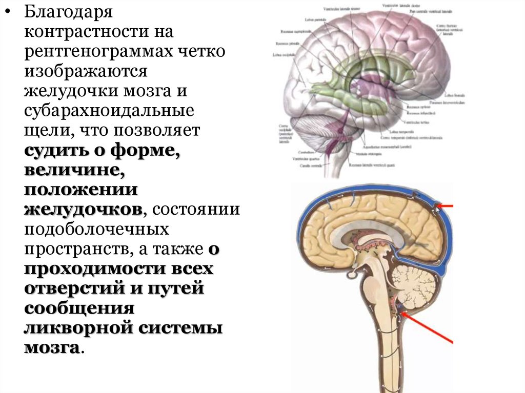 Неравномерное расширение конвекситального. Субарахноидальное пространство головного мозга норма. Подпаутинное субарахноидальное пространство. Цистерны мозжечка анатомия. Расширение субарахноидального конвекситального пространства норма.