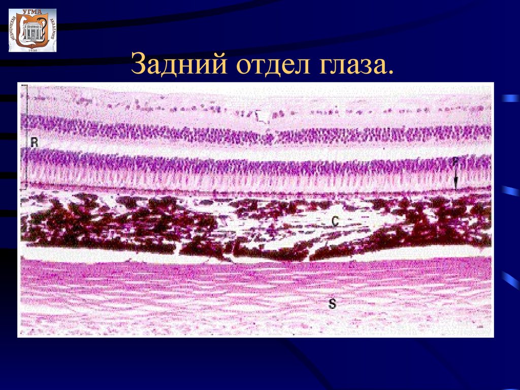 Эпителий сетчатки. Задняя стенка глаза. Задняя стенка глаза гистология. Задний отдел глаза. Задний отдел глаза препарат гистология.