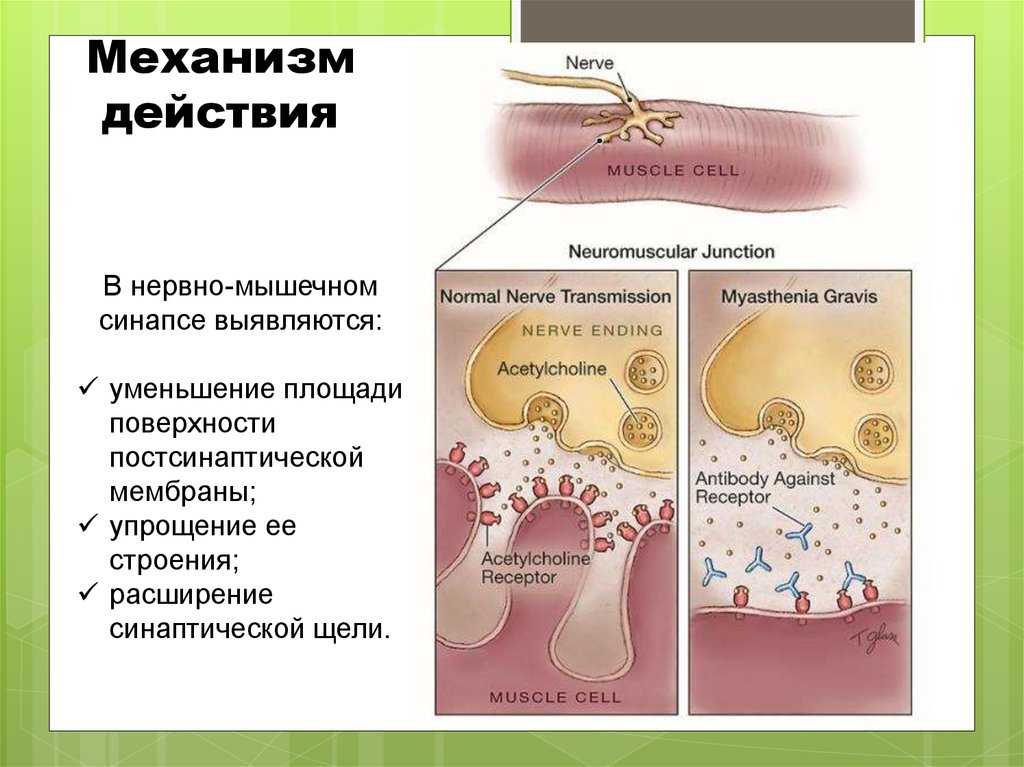 Гастропротекторы механизм действия схема