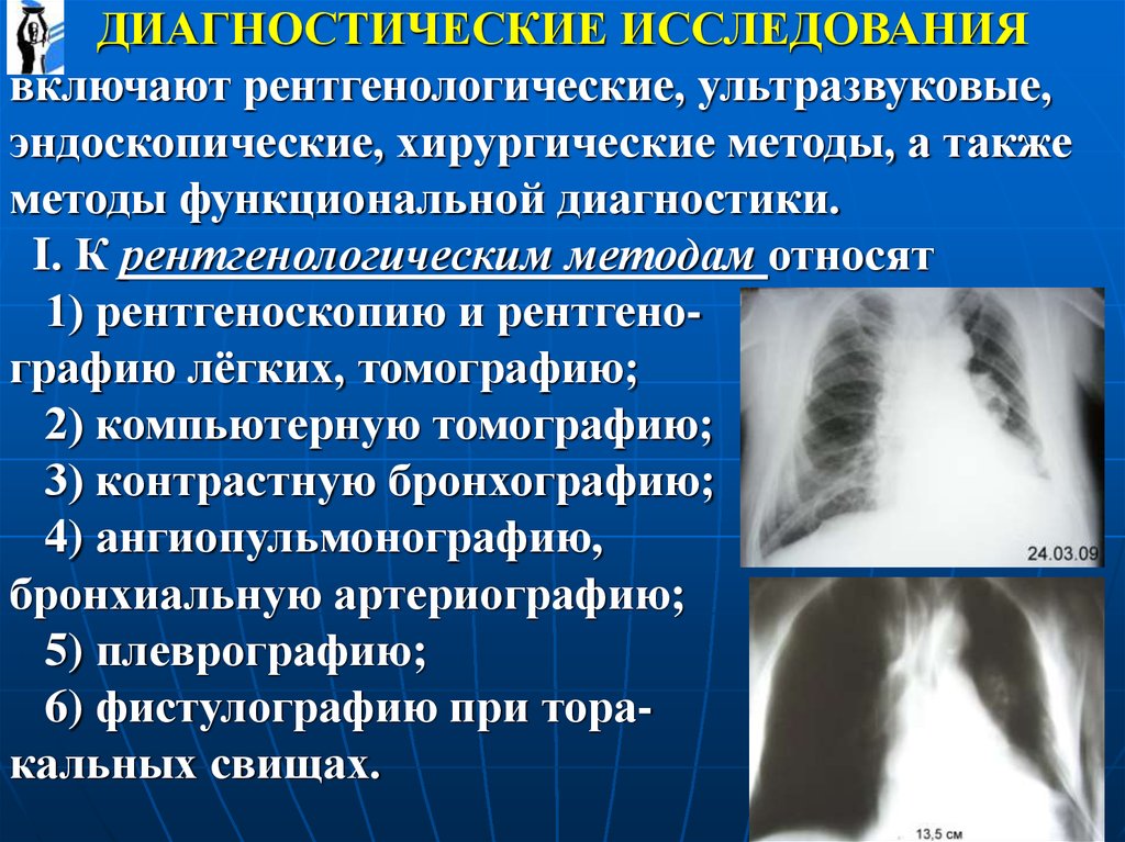 Рентгенологические методы исследования. Рентгенологические методы. Рентгенологические методы диагностики. Рентгенологические и эндоскопические методы. Специальные методы рентгеновского исследования.