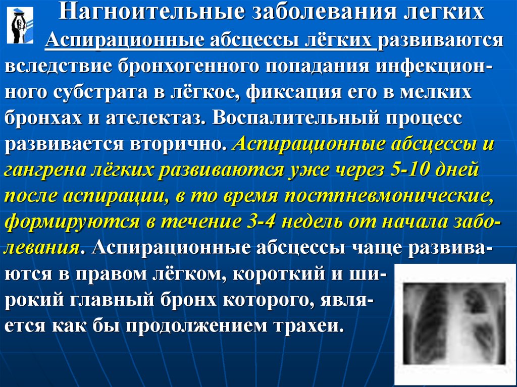 История болезни абсцесс легкого. Нагноительные заболевания. Нагноительные заболевания легкого. Аспирационный абсцесс легкого. Нагноительные процессы в легких.