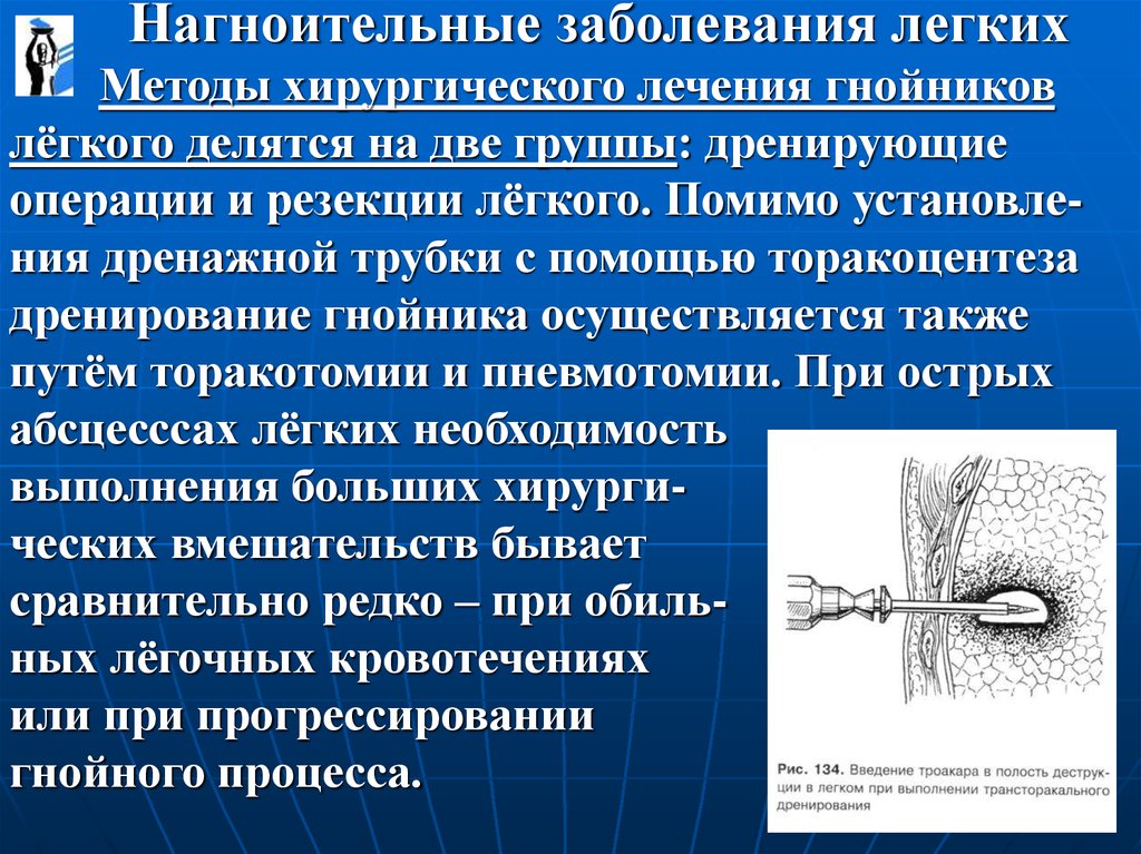 Методы лечения болезни. Нагноительные заболевания легких. Нагноительные легочные заболевания. Нагноительные заболевания легких хирургия. Дренирование легкого методика.