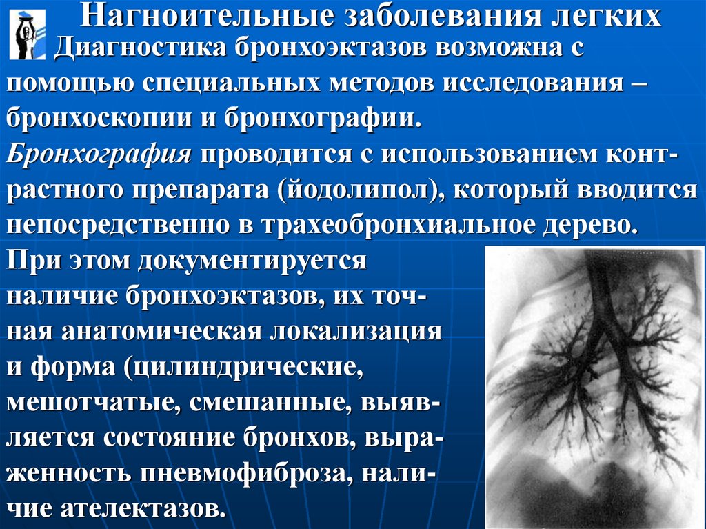 Патология легких. Нагноительные заболевания легких. Дифференциальная диагностика нагноительных заболеваний легких. Методы диагностики хронических нагноительных заболеваний легких:. Заболевания легких названия.