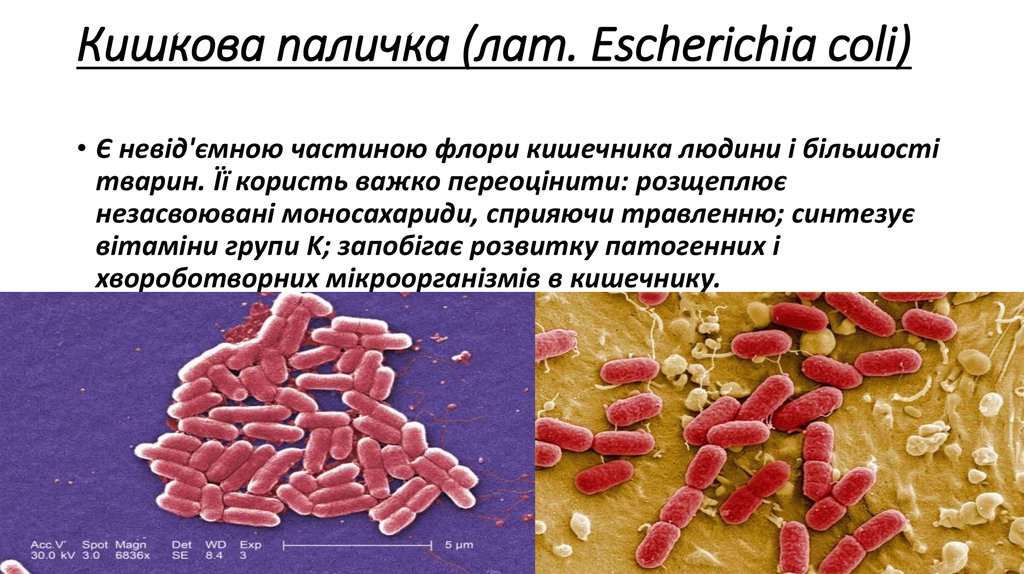 Escherichia coli что это у мужчин. Гемолитические эшерихии. Escherichia coli что гемолизирующая. Эшерихия коли гемолитическая. Гемолитическая эшерихия колли.
