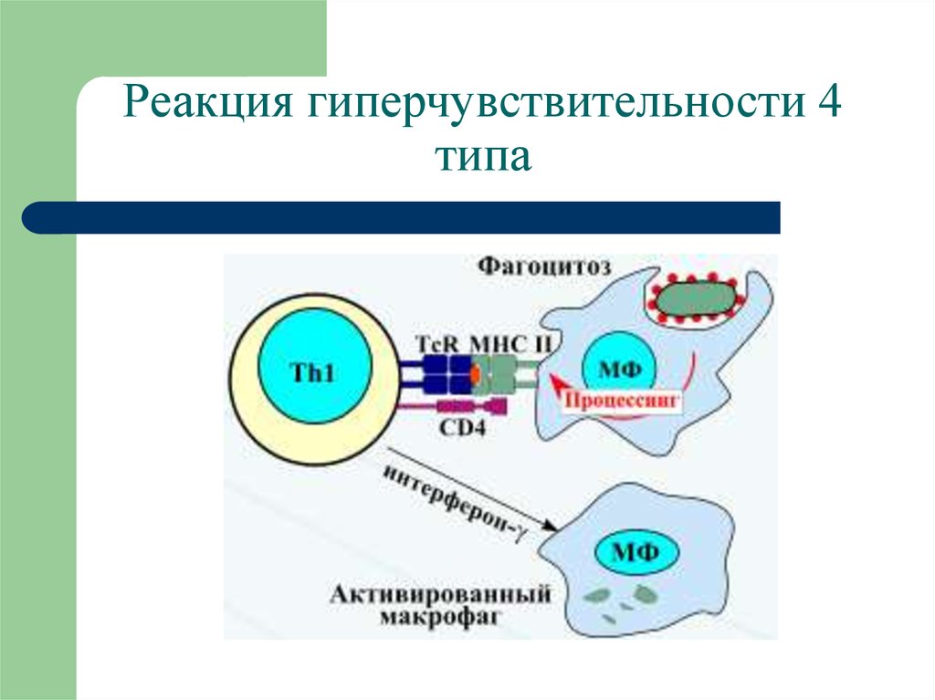 Схема гиперчувствительности 2 типа