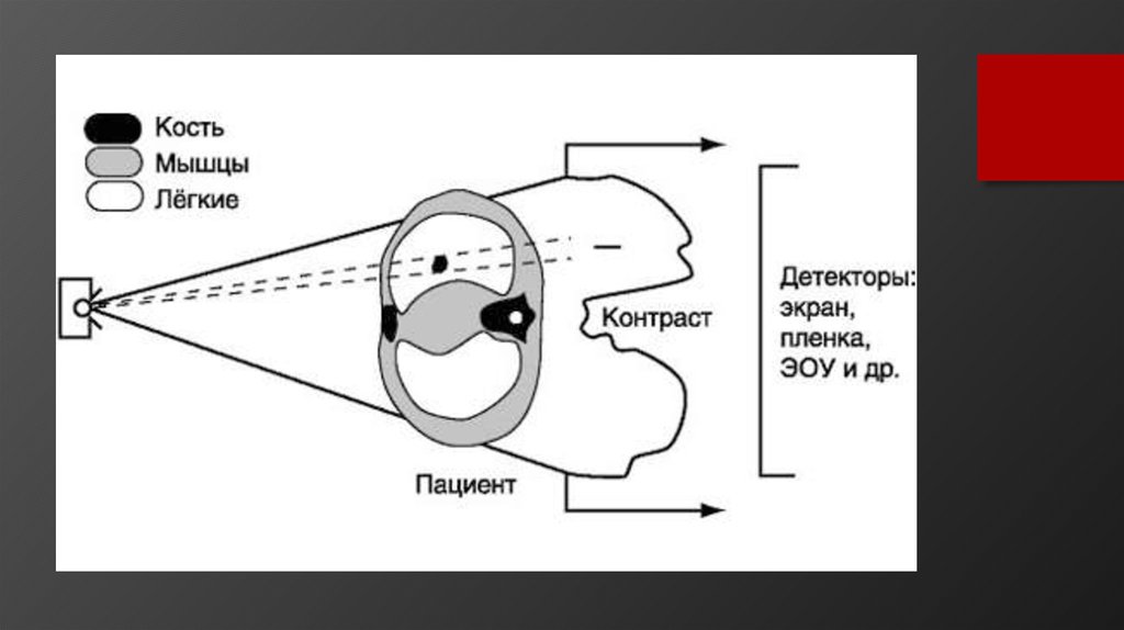 Принципы получения изображения. Схема формирования рентгеновского изображения. Принцип получения рентгеновского изображения. Рентгеноскопия схема аппарата. Схема получения изображения при рентгенографии.