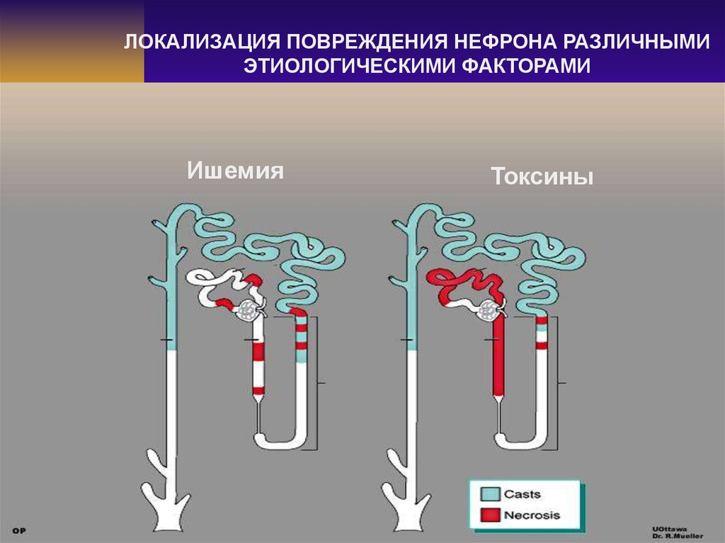 Что происходит в нефроне