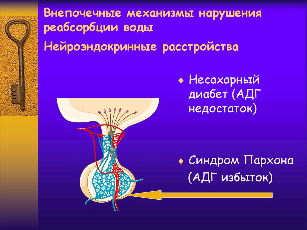 Нарушение реабсорбции почек. АДГ синдром. Несахарный диабет АДГ. Синдром Пархона патогенез. Синдром неадекватной секреции АДГ патогенез.